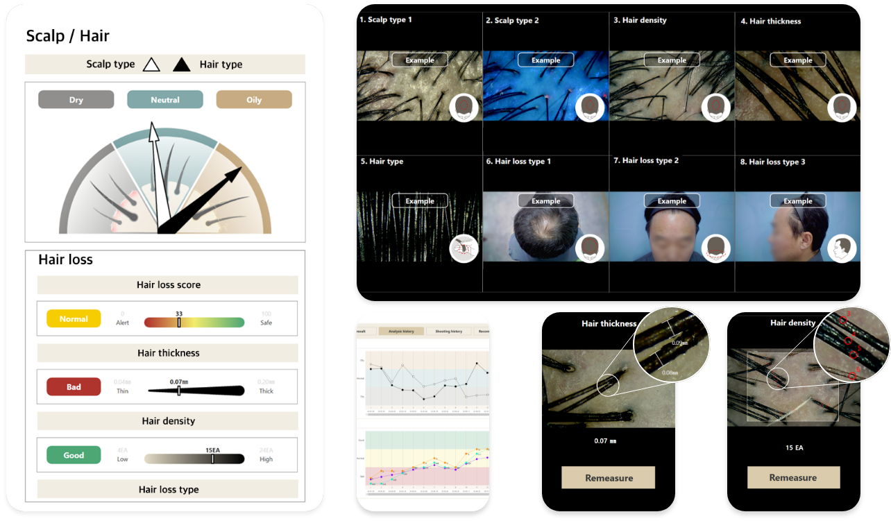 Savremeni problemi: gubitak kose
