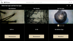 Slikanje tipa i statusa gubitka kose