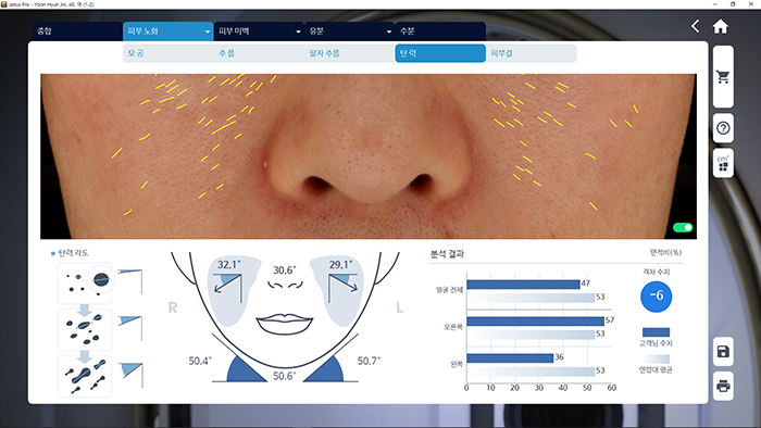 Po prvi put u industriji, vrednosti elastičnosti se mere putem video zapisa.