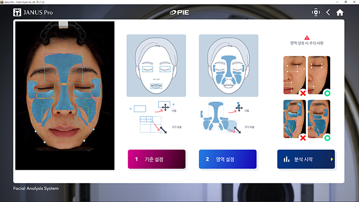 Podesite 10 oblasti i pozicija linije vilice.