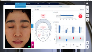 Pore se detaljno analiziraju.