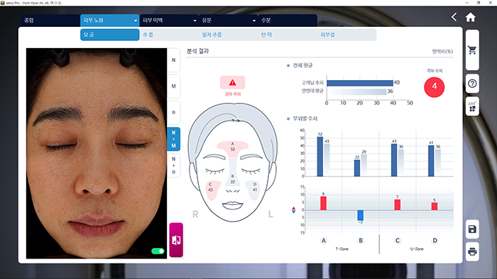 Pore se detaljno analiziraju.