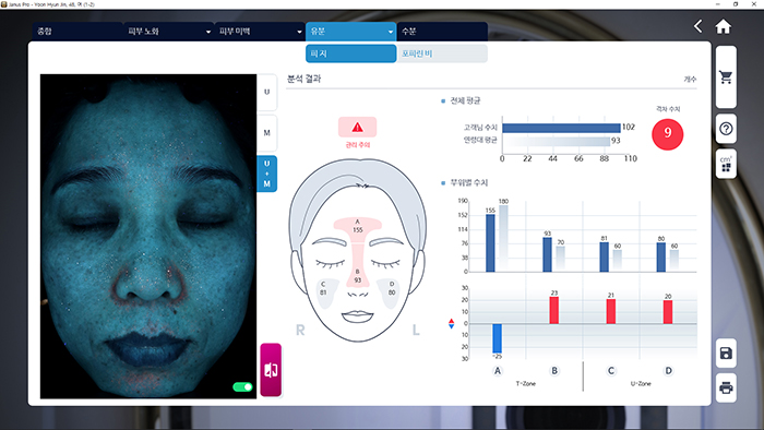 Analiziraju se sebum i porfirin fotografisani pod UV svetlom.