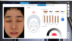 Upoređuju se i analiziraju svetla i tamna područja kože.