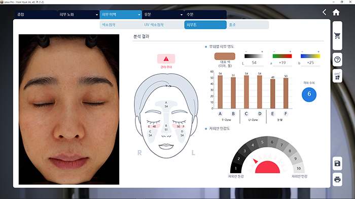 Upoređuju se i analiziraju svetla i tamna područja kože.