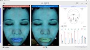 Uporedna analiza (detaljno)